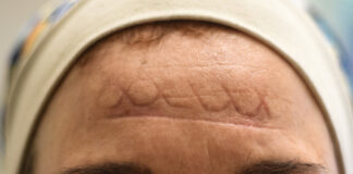 La curva no es una infografía, es una cicatriz